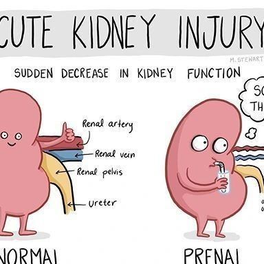 Nursing Assignment Help Service | Nursing Tutor on Instagram: "✨ACUTE KIDNEY INJURY Follow @nursedianamark for more amazing nursing tips, guides and related content. . . . #nursingnotes #nursingstudent #nursing #nursingschool #nurse #nurselife #nurses #studentnurse #nursingschoollife #nursingschoolproblems #nurseinprogress #prenursing #nursingmemes #medicalstudent #nursingstudents #nursingstudentlife #nclexquestions #medical #medicalnotes #nursepractitioner #nursingeducation #nclex #studentnur Kidney Nursing Notes, Acute Kidney Injury Nursing, Kidneys Nursing, Functions Of Kidney, Acute Renal Injury, Nursing School Problems, Acute Kidney Injury, Nursing School Life, Nclex Questions