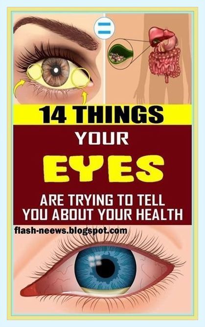 14 Things Your Eyes are Trying to Tell You About Your Health Migraine Aura, Dark Green Vegetables, Computer Vision Syndrome, Cleanse Your Liver, Health Planner, Ffa, For Eyes, Diet Keto, Aging Well