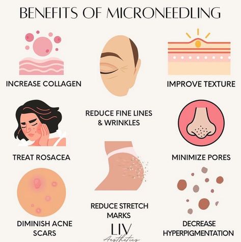 With all of these great benefits, why haven't you tried Microneedling yet???? 🤔 #medspa #microneedling #skincare #selfcare Skin Care Treatments Faces, Self Care Treatments, Skin Care Fun Facts, Microbrasion Facial, Microneedling Marketing, Rf Microneedling Benefits, Med Spa Instagram Post, Micro Needling Benefits, Microneedling After Care