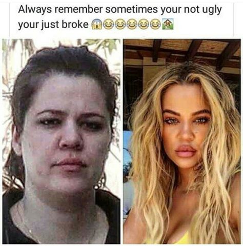 Kim Before And After, Plastic Surgery Gone Wrong, Instagram Vs Real Life, Celebrity Plastic Surgery, Celebrities Before And After, Lip Injections, Without Makeup, Khloe Kardashian, Always Remember