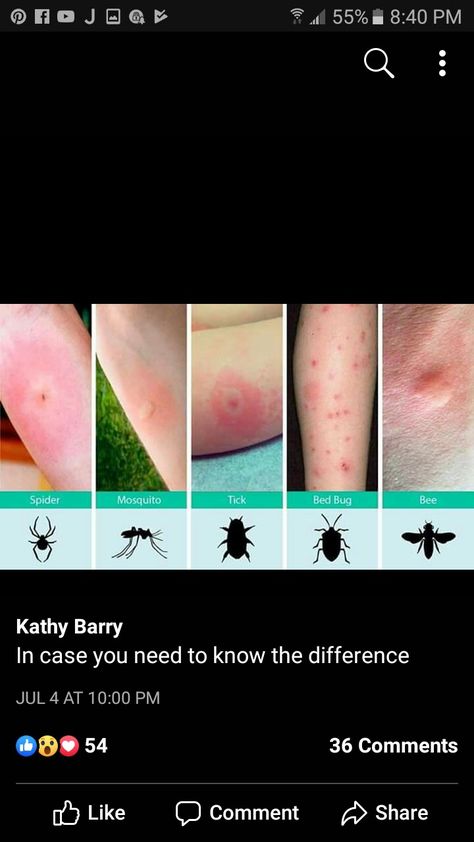 How each insect bite looks. Types Of Bug Bites, Snake Repellant Plants, Snake Repellant, Different Spiders, Remedies For Mosquito Bites, Insect Bite, Frosty Recipe, Types Of Spiders, Get Rid Of Spiders