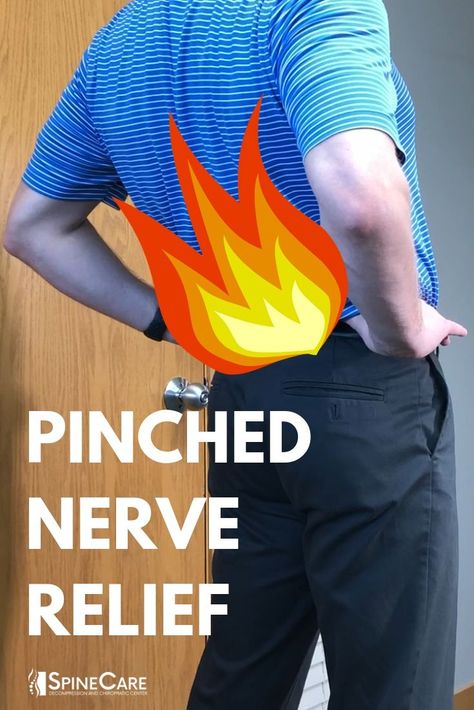 Nerves In Back, Pinched Nerve Relief, Pinched Sciatic Nerve, Dr Rowe, Nerve Relief, Sciatic Nerve Stretches, Sciatic Nerve Relief, Pinched Nerve, Sciatica Pain Relief