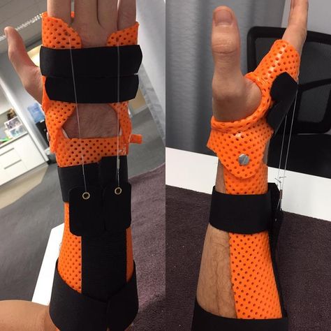 Wrist Extension Activities, Prosthetic Hand Design, Hand Splints Occupational Therapy, Hand Splint, Wrist Fracture, Dupuytren's Contracture, Adjustable Hand-strung Wristband, Thumb Brace, Creative Inventions