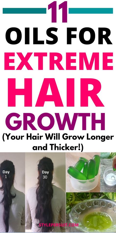 One way to potentially enhance hair growth and improve thickness is by using essential oils. Explore the best essential oils for hair growth and thickness, how to use them, and their individual benefits. Best Essential Oils For Hair, Essential Oils For Hair Growth, Oils For Hair Growth, Grow Natural Hair Faster, Regrow Hair Naturally, Accelerate Hair Growth, Oils For Hair, Thick Hair Growth, Growing Healthy Hair