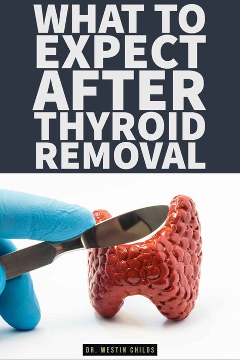 This thyroidectomy recovery guide will walk you through everything you need to know about AFTER thyroid surgery. Thyroid removal is a serious surgery which results in some serious and significant changes to your life. For one, you will be required to take thyroid medication for the rest of your life afterward and this will have serious consequences on how you feel day to day. You should be aware of these symptoms and be prepared for them. This will also help to know if your symptoms are normal! Total Thyroidectomy, Thyroid Removal, Thyroid Surgery, Thyroid Remedies, Low Thyroid, Thyroid Symptoms, Thyroid Medication, Thyroid Issues, Health And Fitness Magazine