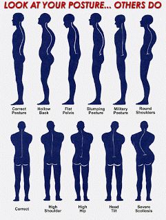 Mr. E's Singing Page Posture Fix, Fix Your Posture, Posture Exercises, Spine Health, Yoga Beginners, Bad Posture, Body Posture, Better Posture, Chiropractic Care