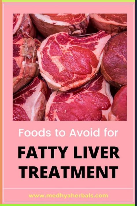 What should I eat for fatty liver diet? Which foods are the best and which foods should I completely avoid? Or Whether it is ok to have some fruits? These maybe some of the questions that brought you here today. Whether you started searching for fatty liver diet out of your own initiative or due to your doctor's prompt; you should know that your diet is the founding pillar of your liver's health. Liver Shrinking Diet, Liver Repair, Liver Diet Plan, Liver Healthy Foods, Healthy Liver Diet, What Should I Eat, Longevity Diet, Free Diet Plans, Liver Recipes