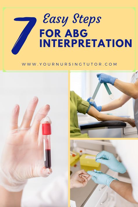 Arterial Blood Gas (ABG) interpretation can be made easy, with a little ABG practice. Easier said than done, unless you know the 7 simple nursing steps that serve as your ABG cheat sheet to get better exam grades and make nursing school easier. Exam Grades, Abg Interpretation, Blood Gas Interpretation, Simple Nursing, Arterial Blood Gas, Normal Values, Lab Values, Clinical Psychology, Nursing Tips