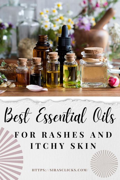 Essential Oils For Rash, Topical Essential Oils, Itchy Skin Rash, Natural Oils For Skin, Home Remedies For Skin, Skin Rashes, Itching Skin, Essential Oils Guide, Oil Skin