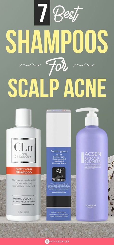 7 Best Shampoos For Scalp Acne: A good scalp acne shampoo can help you get rid of excess oil and product buildup without damaging your hair. Keep reading to check out the 7 best scalp acne shampoos and select the one that is apt for you! #Beauty #BeautyHacks #ScalpAcne Scalp Pimples Remedies, Sores On Scalp Remedies, Scalp Breakouts Remedies, Itchy Scalp Shampoo, Dry Scalp Shampoo, Head Acne, Pimples On Scalp, Sores On Scalp, Itchy Flaky Scalp