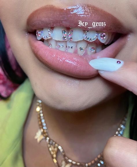 Girl Grillz, Pretty Teeth, Dental Jewelry, Grillz Teeth, Diamond Teeth, Grills Teeth, Tooth Gem, Teeth Jewelry, Cute Piercings