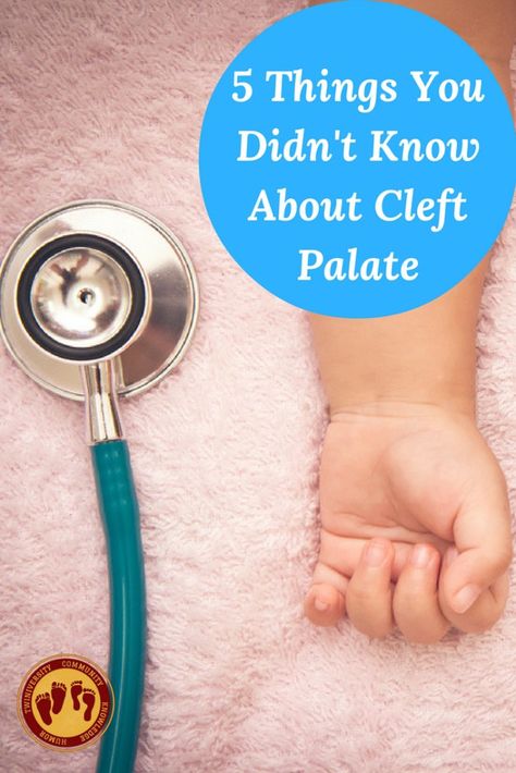 5 Things You Didn't Know About Cleft Palate.  This family shares their unexpected journey with cleft palate. Tandem Nursing, Pediatric Medicine, Cleft Lip And Palate, Breastfeeding Twins, Cleft Palate, Prayer For Baby, Cleft Lip, Speech Delay, Introducing Solids