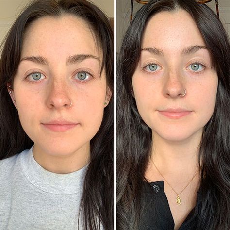 Here’s What Actually Happened To My Face When I Tried Gua Sha Use Gua Sha, Dry Body Brushing, Nasolabial Folds, Blemish Remover, Yoga Facial, My Face When, Beauty Oil, Face Yoga, Face Massage