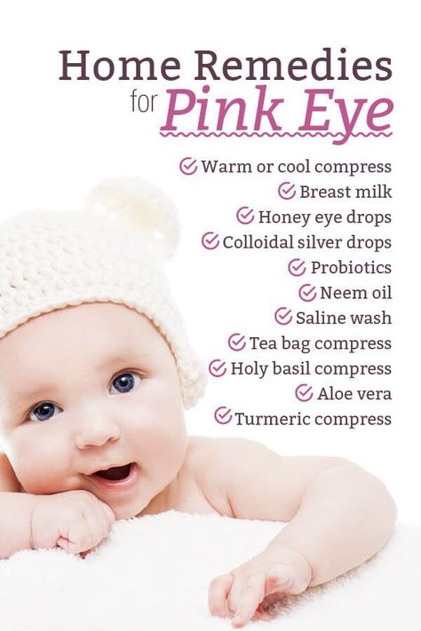 Uh oh! Has pink eye infected your house? Find out how to spot this highly contagious eye infection, plus get soothing, effective home remedies for pink eye. https://www.mamanatural.com/home-remedies-for-pink-eye/ Remedies For Pink Eye, Pinkeye Remedies, Dry Eyes Causes, Swollen Eyes, Irritated Eye, Eye Infections, Pink Eye, Eyes Problems, Cold Sore