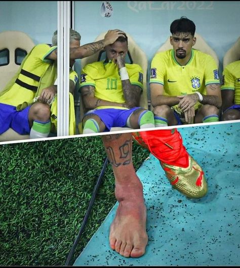 Neymar Injury, Brazil Team, Neymar Football, Messi And Neymar, Ankle Injury, Medical Staff, Football Wallpaper, Intensive Care, Neymar Jr