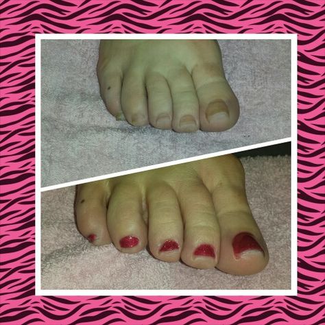 Before and after Pedicure Pedicures, Bathroom Scale