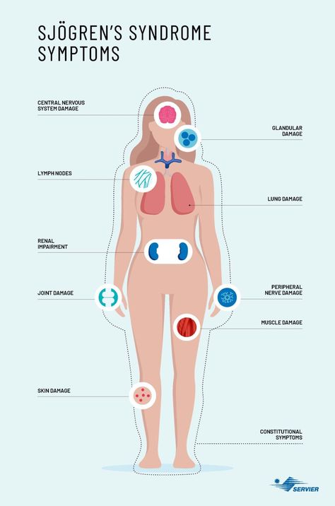 Sjögren’s Syndrome, Sjogrens Syndrome Symptoms, Sjogrens Syndrome Diet, Autoimmune Disease Awareness, Salivary Glands, Autoimmune Disease Symptoms, Dry Eye Symptoms, Fatigue Symptoms, Autoimmune Disorders