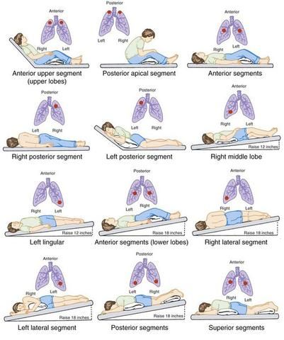 16 Mucus Clearing Techniques That Alleviate Shortness of Breath Postural Drainage, Physical Therapy Student, Basic Anatomy And Physiology, Pulmonology, Respiratory Care, Nursing School Survival, Respiratory Therapy, Lungs Health, Medical School Studying