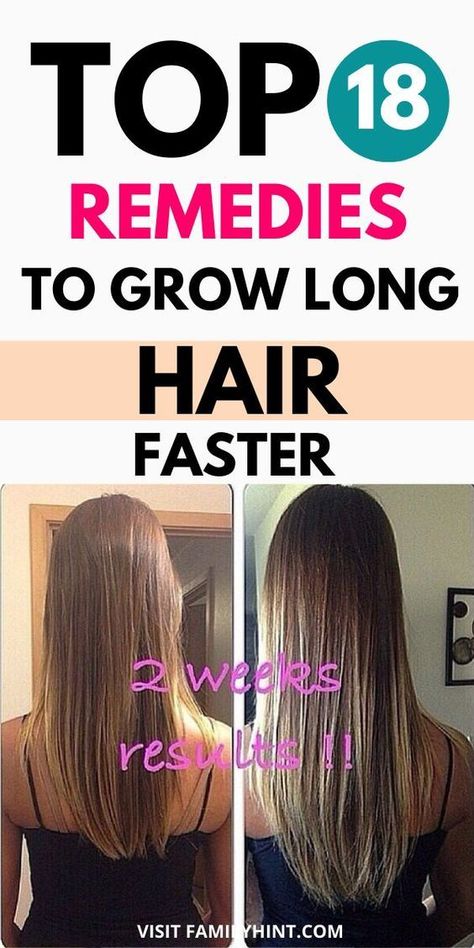 Grow Hair Longer Faster, Hair Longer Faster, Tips To Grow Hair, Ways To Grow Hair, Growing Long Hair Faster, Grow Natural Hair Faster, Make Hair Grow Faster, How To Grow Hair, Longer Hair Faster