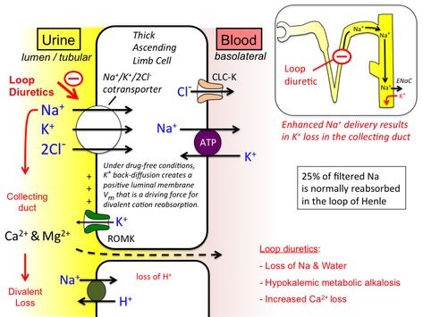 diuretic_pharm [TUSOM | Pharmwiki] Edema Causes, Loop Of Henle, Metabolic Alkalosis, Metabolic Acidosis, Intracranial Pressure, Sms Language, Cell Line, Naturopathic Medicine, Nursing School Studying