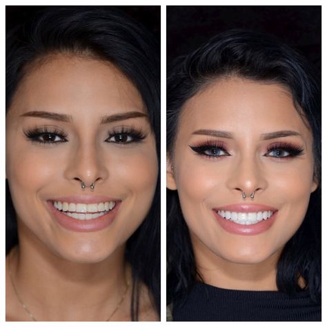 Things to know before you get veneers. Veneer Shapes Teeth, Perfect Smile Teeth Porcelain Veneers, Front Teeth Veneers Before And After, Beautiful Teeth Shape, Celebrity Smiles Teeth, Best Veneers Teeth, Hollywood Smile Veneers, Pop On Veneers Before And After, Teeth Implants Before And After