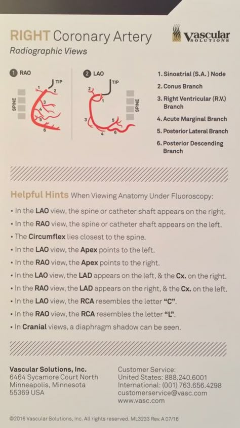 RCA Cardiac Cath Lab Nurse, Cvicu Nursing, Cardiac Cath Lab, Cath Lab Nursing, Cardiac Cath, Cath Lab Nurse, Coronary Circulation, Heart Catheterization, Cardiac Anatomy