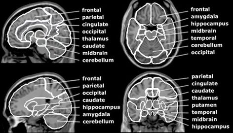 MRI Brain Anatomy | Radiology Anatomy Images Mri Study Guide, Doctor Things, Medical Radiography, Mri Technologist, Mri Brain, Radiology Student, Anatomy Images, Radiology Imaging, Anatomy Bones