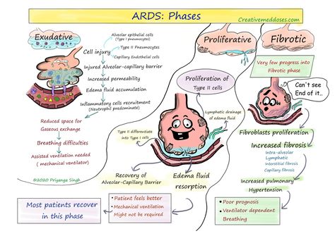 Acute Respiratory Distress, Respiratory Therapy Student, Respiratory Distress, Arterial Blood Gas, Medicine Studies, Nurse Study Notes, Nursing School Survival, Constipation Relief, Fundamentals Of Nursing