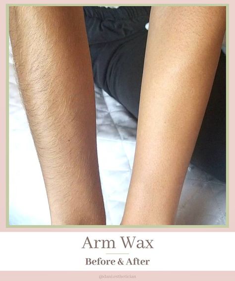 @dani.esthetician showing off the results of her FLAWLESS arm wax using Nova Wax! Smooth skin is always in - treat your skin to the best of the best with Nova Wax! Waxing Before And After, Waxing Arms, Gottman Method, Dream Salon, Hair Wax, Beauty Services, Best Of The Best, Free Hair, Marriage Advice