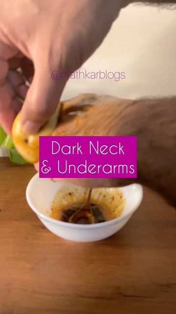 Dark Neck Remedies, Hair Self Care, Get Rid Of Dark Neck, Dark Patches On Skin, Dark Inner Thighs, Dark Neck, Dark Elbows, Skin Darkening, Dark Eye Circles