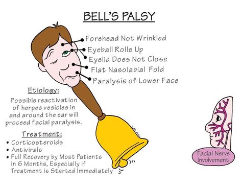 Nursing Mnemonics: Bells Palsy Nursing Neuro, Neuro Nursing, Memory Notebook, Nursing Information, Bells Palsy, Nursing Mnemonics, Surgical Nursing, Medical Surgical Nursing, Nursing School Survival