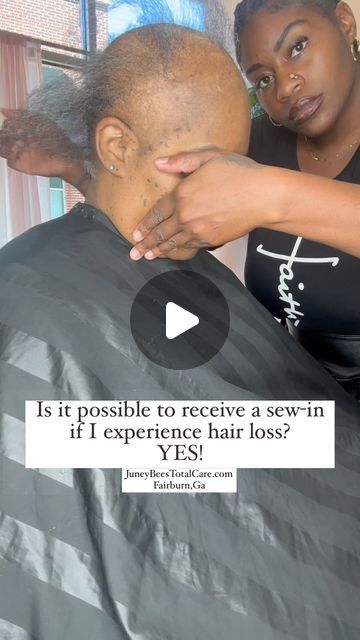 Alopecia Hairstyles Black Women, Make The Impossible Possible, Alopecia Hairstyles, Traction Alopecia, Impossible Possible, Sew In Hairstyles, Come See Me, December 13, The Impossible