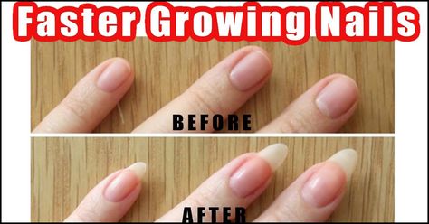 When it comes to taking care of your nails, getting a manicure is not the only option. In fact, you must take care of your nails on a daily basis. We have listed some easy nail care tips and tricks you can try at home to keep your nails clean and beautiful. Grow Long Nails, Nail Growth Tips, Grow Nails Faster, Natural Nail Care, Natural Nail Designs, Nail Care Tips, Brittle Nails, Shiny Nails, How To Grow Nails