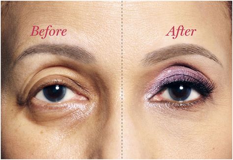 Eye Makeup for Droopy Eyes Makeup For Droopy Eyelids, Droopy Eye Makeup, Drooping Eyelids, Corrective Makeup, Droopy Eyelids, Droopy Eyes, Makeup Tip, Hooded Eye Makeup, Dark Circles Under Eyes