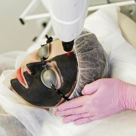 CosmeticPerks on Instagram: “Don't be scared! This carbon peel might look strange, but it's perfect for acne-prone skin types. A layer of liquid carbon is applied to…” Hollywood Peel, Carbon Peel, Laser Peel, Laser Facial, Vampire Facial, Skin Medica, Skin Imperfection, Cosmetic Procedures, Medical Spa