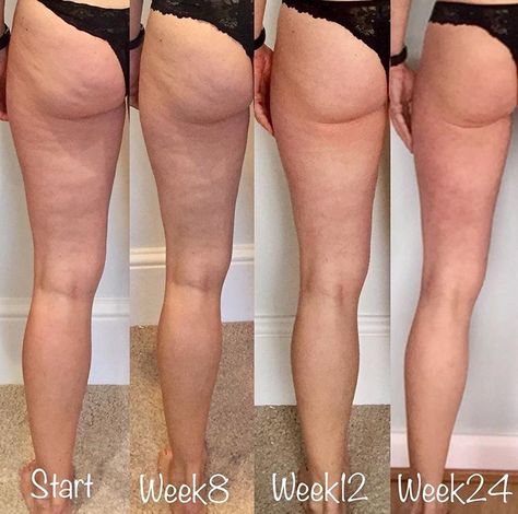 Leg progress Leg Transformation, Shape Transformation, Benefits Of Squats, Diets For Women, Diet Keto, Transformation Body, Active Women, Weight Management, Personal Training