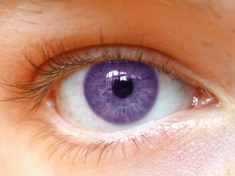 Light Purple Eye Rare Eye Colors, Dry Eyes Causes, Steel Blue Eyes, Rare Eyes, Laser Eye Surgery, Beautiful Eyes Color, Eye Sight Improvement, Eye Exercises, Vision Eye