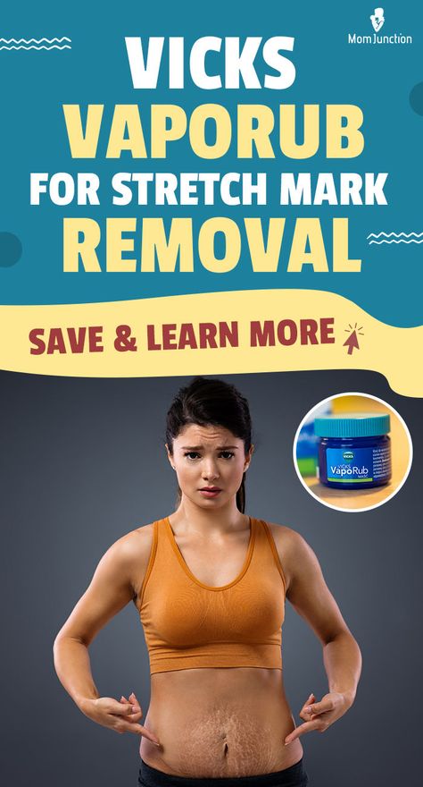 Got stretch marks? Don't worry! Here's why they appear & how to minimize them. Strech Marks Removal, Whiteheads Removal, Best Peel Off Mask, Stretch Mark Removal Cream, Stretch Mark Remedies, Body Firming Cream, Body Firming, Face Care Routine, Stretch Mark Removal