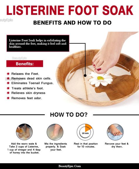 Listerine Foot Soak: Benefits and How It Works Home Foot Soak, Pedicure Soak, Listerine Foot Soak, Foot Soak Recipe, Diy Pedicure, Pedicure At Home, Athletes Foot, Foot Soak, Foot Spa