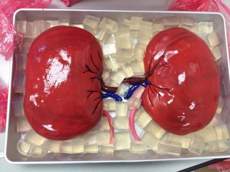 Kidney Transplant cake... for a nursing school project Medical Pumpkin Decorating Contest, Medical Pumpkin, Kidney Cake, Human Body Science Projects, Kidney Donation, Theme Snack, Body Science, Human Body Science, Contest Ideas