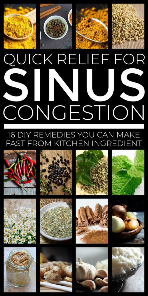 Sinus Congestion Relief At Home Congestion Relief, Homemade Sinus Remedies, Essential Oils For Sinus Drainage, Sinus Inflammation Relief, Herbs For Sinus Congestion, Natural Decongestant Nasal Congestion, Herbs For Congestion, Home Remedies For Sinus Infection, Head Congestion Relief