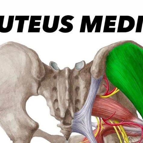 Fix Your Back Pain on Instagram: "💥𝐆𝐥𝐮𝐭𝐞𝐮𝐬 𝐌𝐞𝐝𝐢𝐮𝐬💥
———
🔎Gluteus medius is an important abductor and stabilizer of the hip joint (see yesterday’s post). Resistance training that targets the hip abductors often helps reduce pain associated with patellofemoral syndrome, IT band syndrome, hip impingement, gluteal tendinopathy and low back pain.

🧠Here are 5 great exercises for strengthening gluteus medius and gluteus minimus as a part of a prehab program or with someone who is suffering from one of the clinical conditions mentioned above.

1️⃣Pelvic Dips: This exercise helps to control the pelvis by preventing it from dropping during single-limb stance, which is termed contralateral pelvic drop (CPD). In this exercise, the leg that needs work is placed on the step (right leg i Gluteal Tendinopathy, Hip Impingement, Gluteus Minimus, Hip Abductors, Gluteus Medius, It Band, Back Pain Exercises, Resistance Training, Low Back Pain