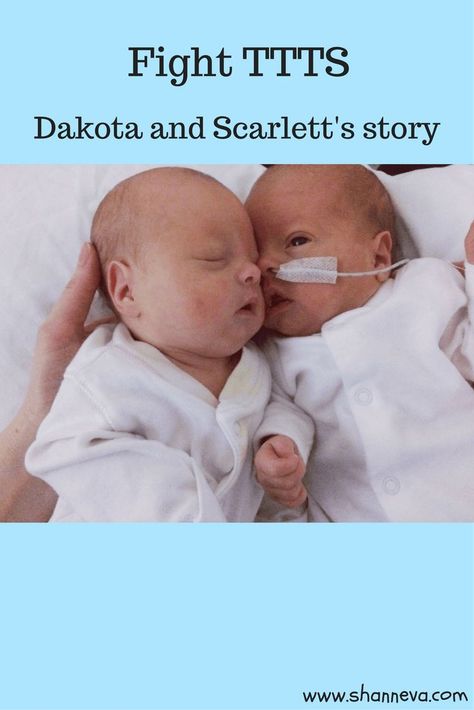 TTTS is a very serious disease that affects twins and higher multiple births. Learn about this deadly disease, what you can do, and how you can fight TTTS. Twin To Twin Transfusion Syndrome, Multiple Births, Mommy Loves You, Premature Birth, Micro Preemie, Twin Pregnancy, Twin Mom, Quotes About Motherhood, Toddler Mom