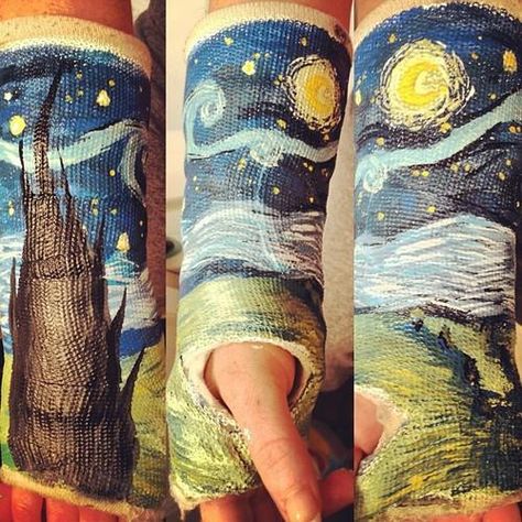 11 Awesomely Decorated Casts Worth a Broken Bone | Mental Floss Cassandra Calin, Cast Art, Behind Blue Eyes, The Starry Night, Pahlawan Super, 웃긴 사진, Cool Stuff, Tumblr Funny, Tumblr Posts