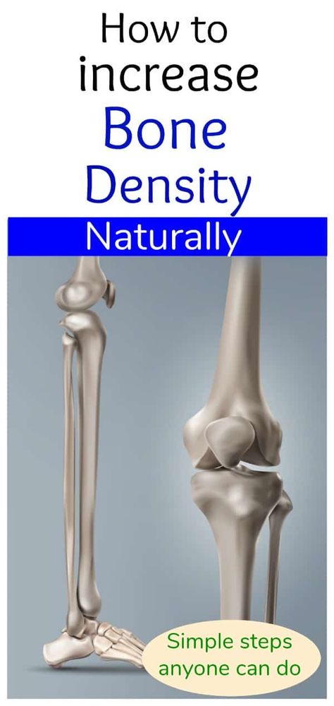 We are all concerned about bone density as we age, and Dr. Amy Lanou, Ph.D. helps us understand what we can do to help ourselves in this article. Bone Density Exercises, Osteoporosis Diet, Osteoporosis Exercises, Osteoporosis Prevention, Bone Strengthening, Bone Healing, Increase Bone Density, Baking Soda Beauty Uses, Bone Strength