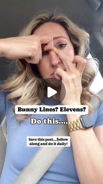 FROWNIES: The Original Wrinkle Patch on Instagram: "If you hold a lot of stress and tension in your brow this is going to be a game changer for you!  When you have eleven lines or bunny lines that’s really just an indicator that you’re likely unconsciously furrowing your brow all day long!  Try this technique! It might be a little tender at first….and of course that’s a sign you probably need it even more!  This is great to do before applying your Frownies!  It’s meant to be done without oil….you want firm pressure so you’re getting to the muscle not just gliding on the skin!  Let me know if this is helpful!  Follow for more tips on reading the tension in your face and brow and softening those expression lines without Botox!  #frownies #bunnylines #relaxforeheadlines" Spots On Face, In Your Face, Facial Massage, A Sign, Plastic Surgery, Game Changer, Follow For More, Beauty Tips, Beauty Hacks