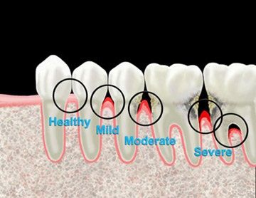 Dental Assistant Study, Registered Dental Hygienist, Dental Hygiene Student, Dental Images, Dental World, Dental Education, Dental Posts, Dental Assisting, Dental Hygiene School