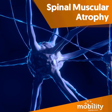 Click the link and learn more about it. https://www.mobilityequip.com/blog/spinal-muscular-atrophy/ Spinal Muscular Atrophy, Motor Neuron, Genetic Diseases, Click The Link, Disease, Movie Posters, Film Posters