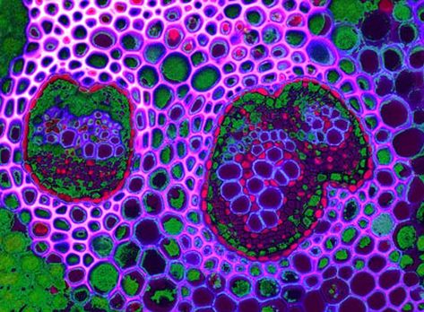 It's a small world: Fascinating images of life under the microscope | Daily Mail Online Magnified Art, Microscope Images, Microscopic Cells, Cell Art, Yellena James, Human Cell, Blacklight Art, Nature Patterns, Macro Pictures