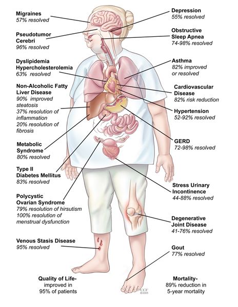 Makanan Diet, Diet Keto, The Human Body, Health Info, Reduce Weight, Migraine, Get In Shape, Fitness Diet, Healthy Weight